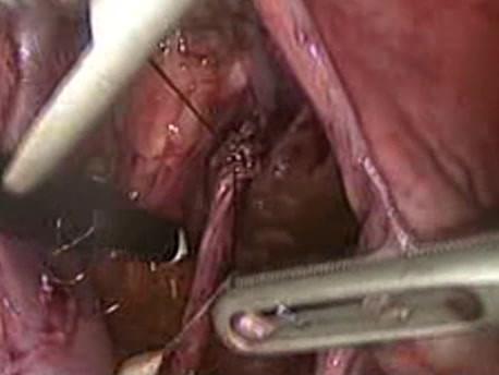 https://cdn.ncbi.nlm.nih.gov/pmc/blobs/3c8b/3499187/24accb365eec/1477-7819-10-177-2.jpg