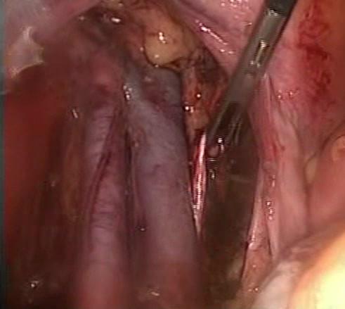https://cdn.ncbi.nlm.nih.gov/pmc/blobs/3c8b/3499187/ef660e4a7db5/1477-7819-10-177-1.jpg