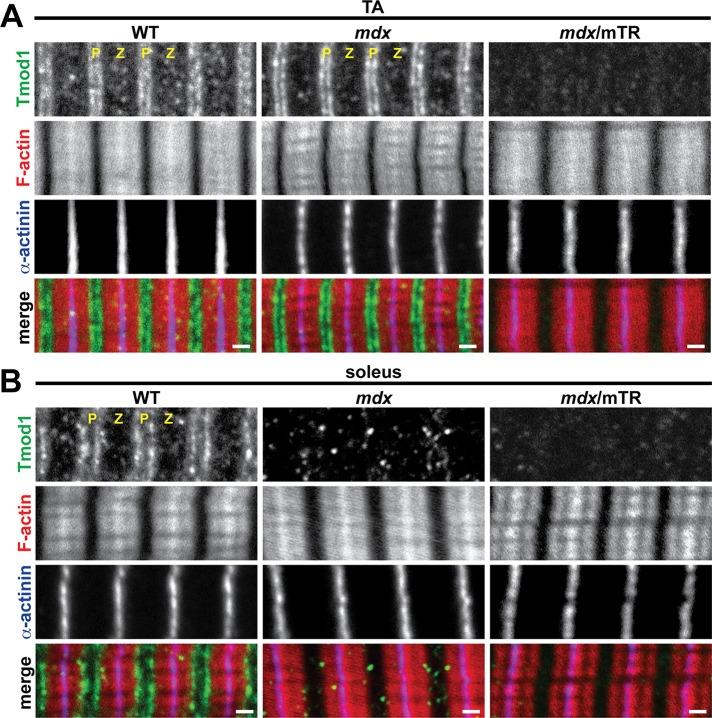 https://cdn.ncbi.nlm.nih.gov/pmc/blobs/3c8b/3952854/45cffcad89a7/852fig4.jpg