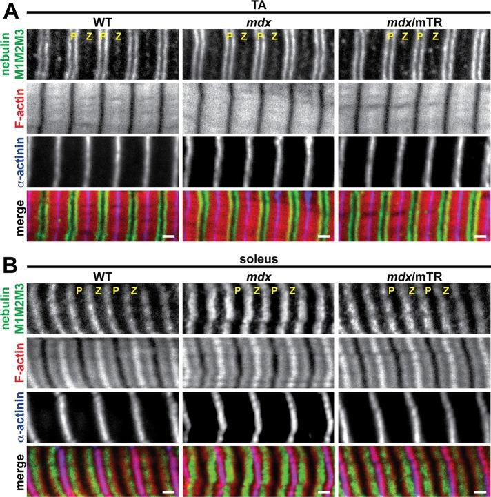 https://cdn.ncbi.nlm.nih.gov/pmc/blobs/3c8b/3952854/4b251cd95af8/852fig6.jpg