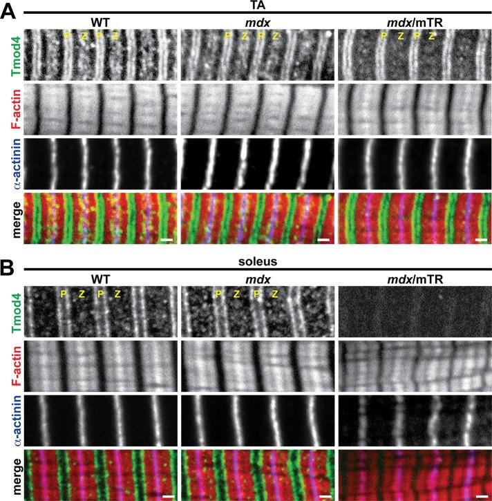 https://cdn.ncbi.nlm.nih.gov/pmc/blobs/3c8b/3952854/75de627c0868/852fig5.jpg