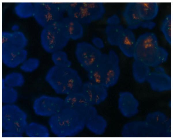 https://cdn.ncbi.nlm.nih.gov/pmc/blobs/3c8f/2887399/39d3e8fae48a/1471-2407-10-189-2.jpg