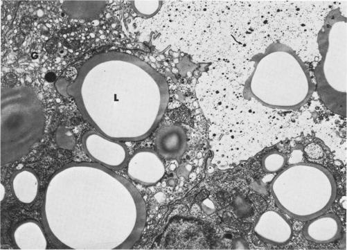 https://cdn.ncbi.nlm.nih.gov/pmc/blobs/3c90/2032880/02150608bee6/amjpathol00564-0155-a.jpg
