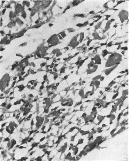 https://cdn.ncbi.nlm.nih.gov/pmc/blobs/3c91/1989486/1c52795129fa/brmedj02091-0025-d.jpg