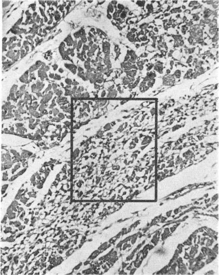https://cdn.ncbi.nlm.nih.gov/pmc/blobs/3c91/1989486/6469996d036b/brmedj02091-0025-c.jpg