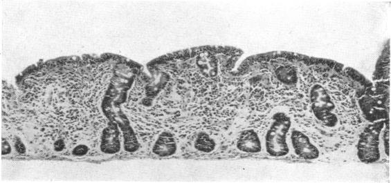 https://cdn.ncbi.nlm.nih.gov/pmc/blobs/3c91/1989486/8139ecb89e35/brmedj02091-0025-b.jpg