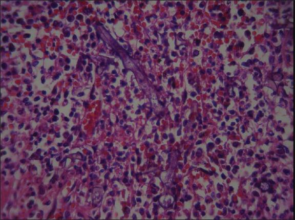 https://cdn.ncbi.nlm.nih.gov/pmc/blobs/3c93/3898454/84a27705d9f6/IJPVM-4-1468-g003.jpg