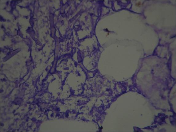 https://cdn.ncbi.nlm.nih.gov/pmc/blobs/3c93/3898454/94c68ca40370/IJPVM-4-1468-g002.jpg