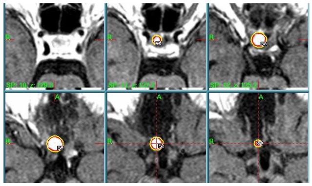 https://cdn.ncbi.nlm.nih.gov/pmc/blobs/3c96/12072044/725760bd1792/cancers-17-01564-g006.jpg