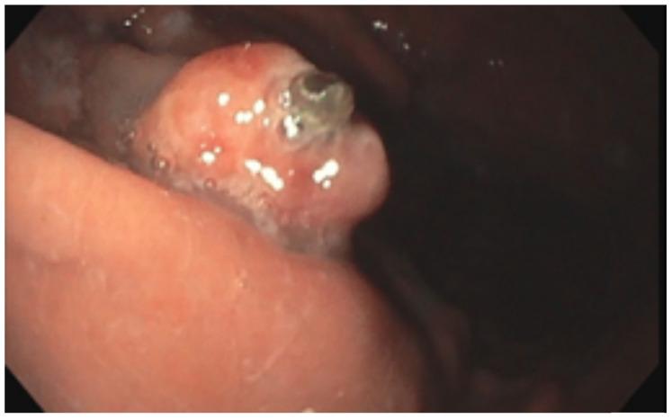 https://cdn.ncbi.nlm.nih.gov/pmc/blobs/3c9c/11131944/437322e9a4d3/fonc-14-1354127-g001.jpg