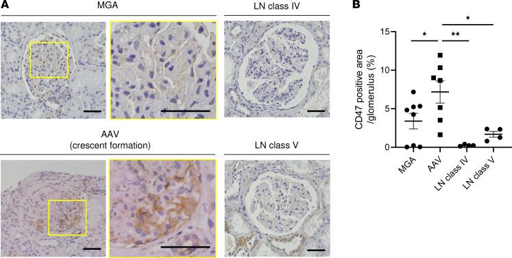 https://cdn.ncbi.nlm.nih.gov/pmc/blobs/3c9e/10445685/e9ee054db5ab/jciinsight-8-167486-g051.jpg