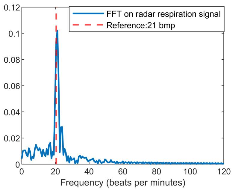 https://cdn.ncbi.nlm.nih.gov/pmc/blobs/3ca1/8747437/96eac2bd0e7b/sensors-22-00083-g006.jpg