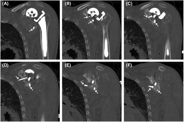 https://cdn.ncbi.nlm.nih.gov/pmc/blobs/3ca1/9508804/f2deaea9bef7/CCR3-10-e06374-g005.jpg