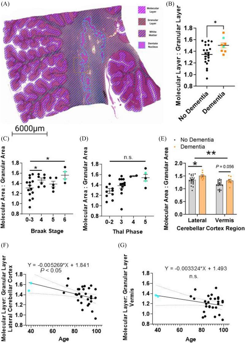 https://cdn.ncbi.nlm.nih.gov/pmc/blobs/3cb5/11848203/3d03fb2b5f8f/ALZ-21-e14428-g001.jpg