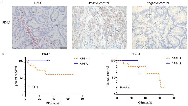 https://cdn.ncbi.nlm.nih.gov/pmc/blobs/3cbb/10162038/c84eb9a2470e/peerj-11-15261-g008.jpg