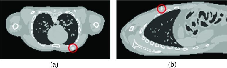 https://cdn.ncbi.nlm.nih.gov/pmc/blobs/3cbb/6726464/cfecf1e0b6c9/motai4ab-2935721.jpg