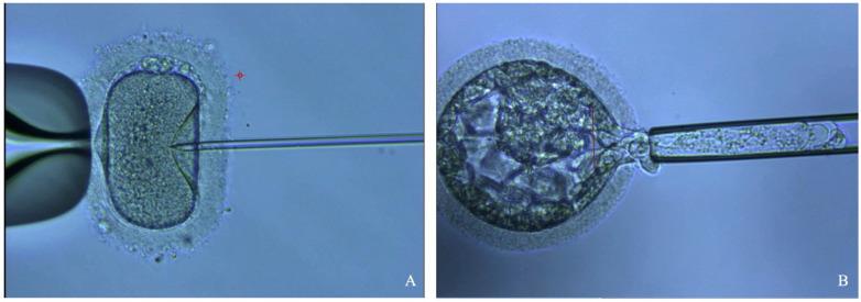 https://cdn.ncbi.nlm.nih.gov/pmc/blobs/3cbe/11355217/9fdcf00a672e/jcm-13-04939-g002.jpg