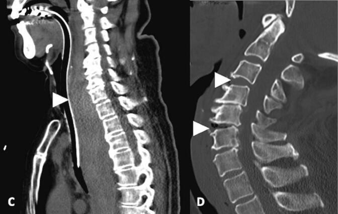 https://cdn.ncbi.nlm.nih.gov/pmc/blobs/3cc2/10440353/c8d7bf350005/gr2.jpg