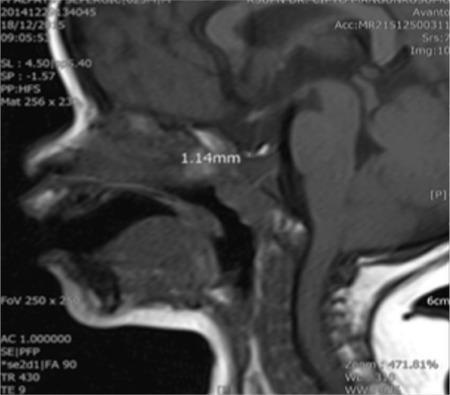 https://cdn.ncbi.nlm.nih.gov/pmc/blobs/3cc2/6878336/c0fa1febf9df/JCRPE-11-426-g3.jpg