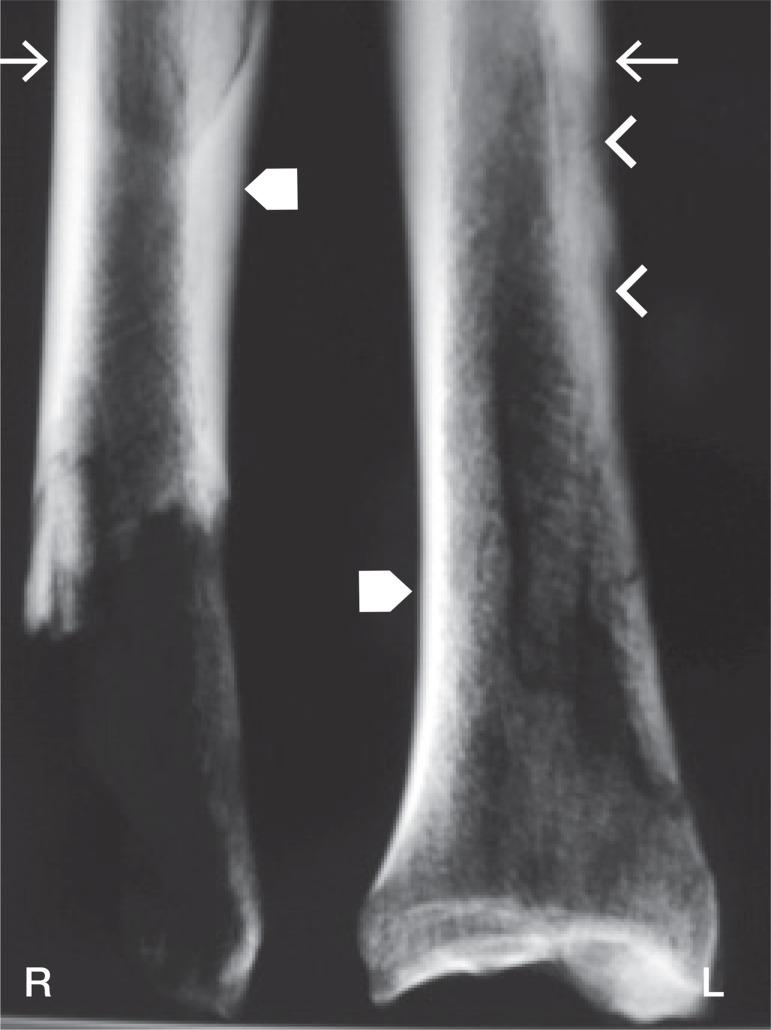 https://cdn.ncbi.nlm.nih.gov/pmc/blobs/3cc3/4164875/ac79197f21c3/ORT-85-543-g004.jpg
