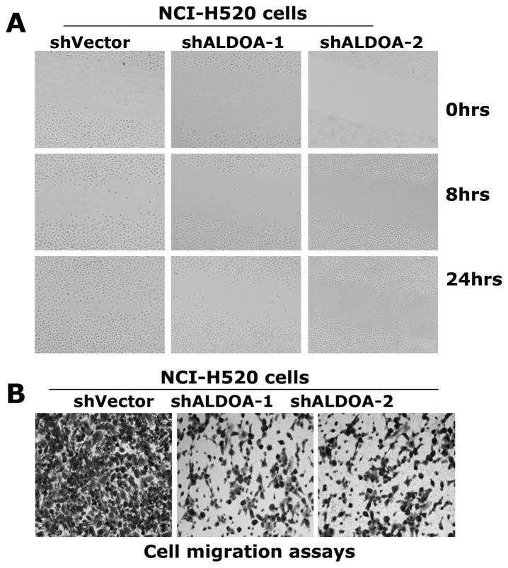 https://cdn.ncbi.nlm.nih.gov/pmc/blobs/3cc9/3900443/ccf17fea935a/pone.0085804.g006.jpg
