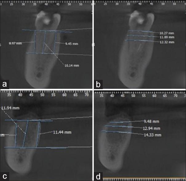 https://cdn.ncbi.nlm.nih.gov/pmc/blobs/3cca/10906784/6af4ba02388e/JISP-27-619-g006.jpg