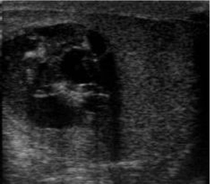 https://cdn.ncbi.nlm.nih.gov/pmc/blobs/3cd0/8413212/81a53a273fcf/IJU5-4-289-g001.jpg