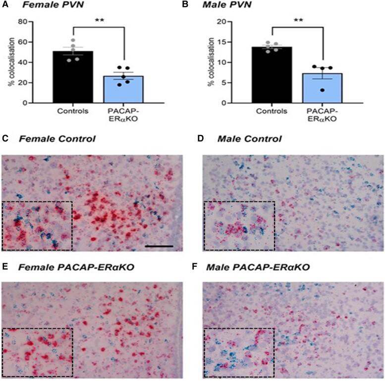 https://cdn.ncbi.nlm.nih.gov/pmc/blobs/3cd5/10341598/48a9a7155d5f/bqad097f8.jpg