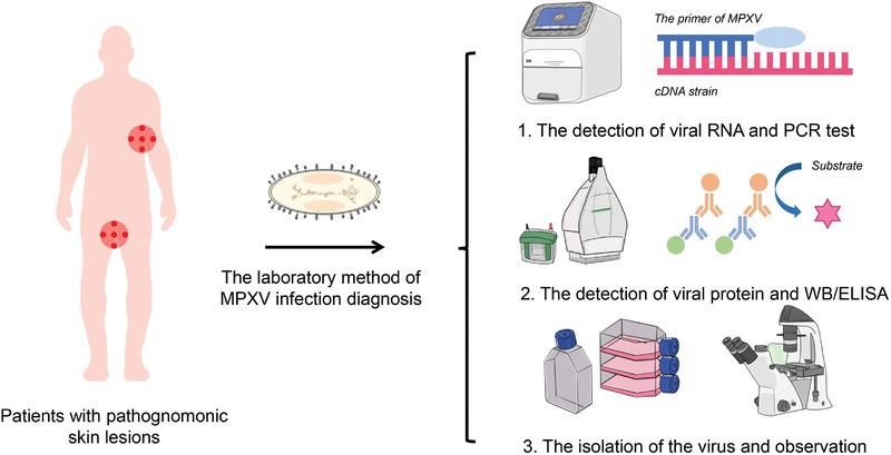 https://cdn.ncbi.nlm.nih.gov/pmc/blobs/3cd5/12087419/21557dd9029d/EXP2-5-20230112-g016.jpg
