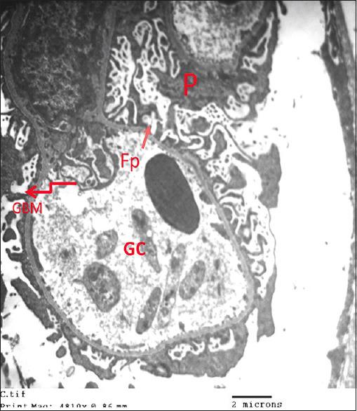 https://cdn.ncbi.nlm.nih.gov/pmc/blobs/3cd6/11729022/1b00557fc1d0/JMAU-12-199-g015.jpg