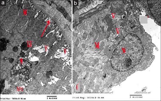 https://cdn.ncbi.nlm.nih.gov/pmc/blobs/3cd6/11729022/d8b730bbf43a/JMAU-12-199-g010.jpg