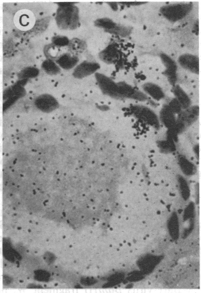 https://cdn.ncbi.nlm.nih.gov/pmc/blobs/3cd6/282863/3b03a130c21f/pnas00303-0411-b.jpg