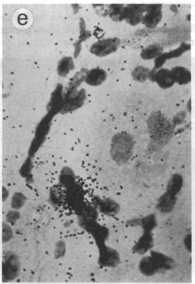 https://cdn.ncbi.nlm.nih.gov/pmc/blobs/3cd6/282863/49a8967c4998/pnas00303-0411-e.jpg