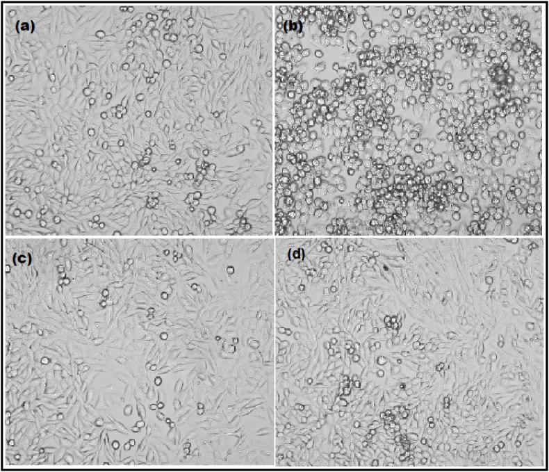 https://cdn.ncbi.nlm.nih.gov/pmc/blobs/3ce5/10559994/6bbd535cea00/gr12.jpg