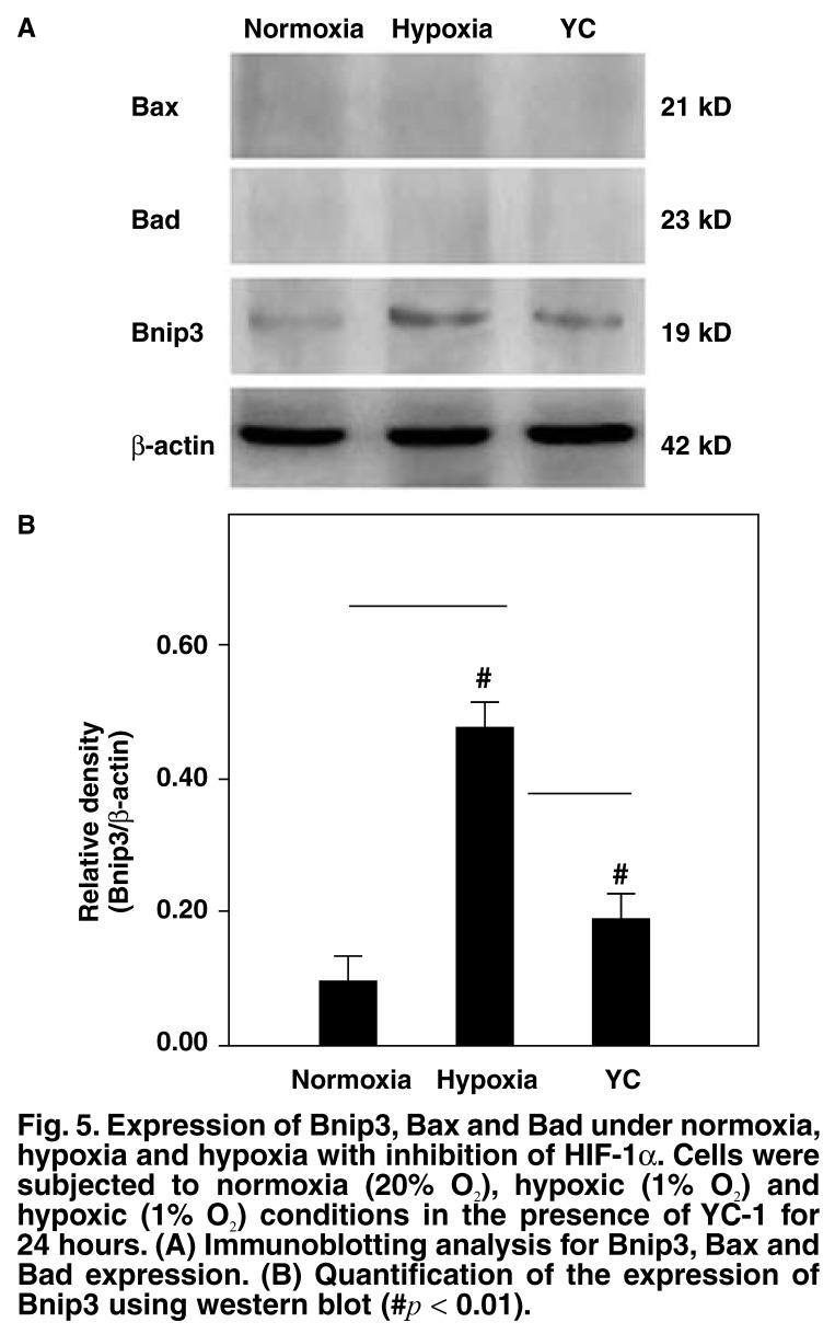 https://cdn.ncbi.nlm.nih.gov/pmc/blobs/3ce5/3721275/31c89f212b14/cvja-21-40-g005.jpg