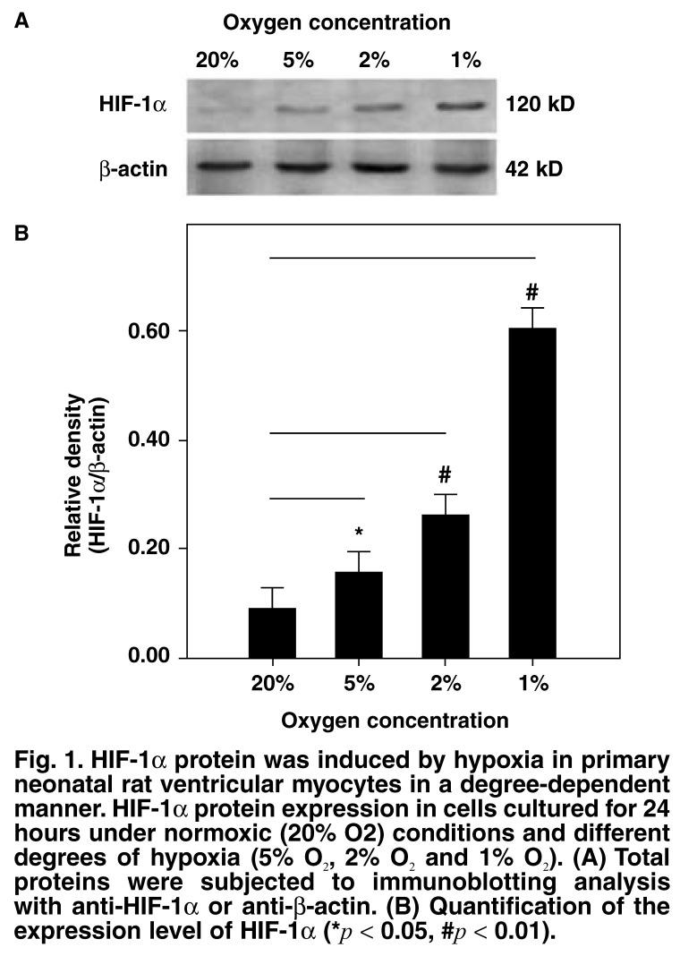 https://cdn.ncbi.nlm.nih.gov/pmc/blobs/3ce5/3721275/9e8ae6120118/cvja-21-38-g001.jpg