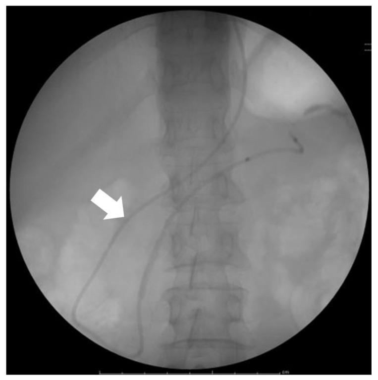 https://cdn.ncbi.nlm.nih.gov/pmc/blobs/3cea/10297586/8413bb0847fd/diagnostics-13-02080-g004.jpg