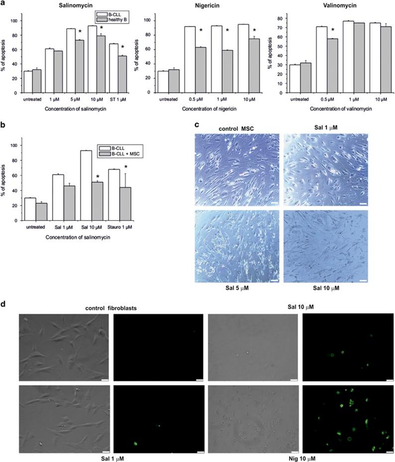 https://cdn.ncbi.nlm.nih.gov/pmc/blobs/3ced/4632293/7faf433e13eb/cddis2015263f5.jpg