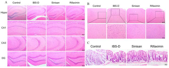 https://cdn.ncbi.nlm.nih.gov/pmc/blobs/3cee/11476996/c25e35c54ed0/ijms-25-10262-g004.jpg