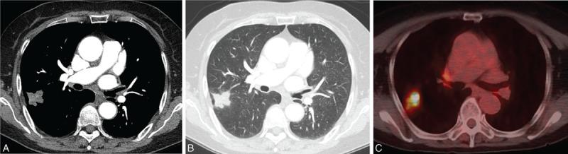 https://cdn.ncbi.nlm.nih.gov/pmc/blobs/3cee/4937910/19fb9264b23d/medi-95-e3978-g003.jpg