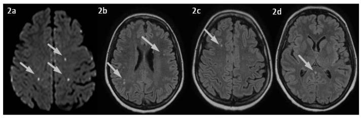 https://cdn.ncbi.nlm.nih.gov/pmc/blobs/3cf1/10672691/37f2462ff2dc/jpm-13-01557-g002.jpg