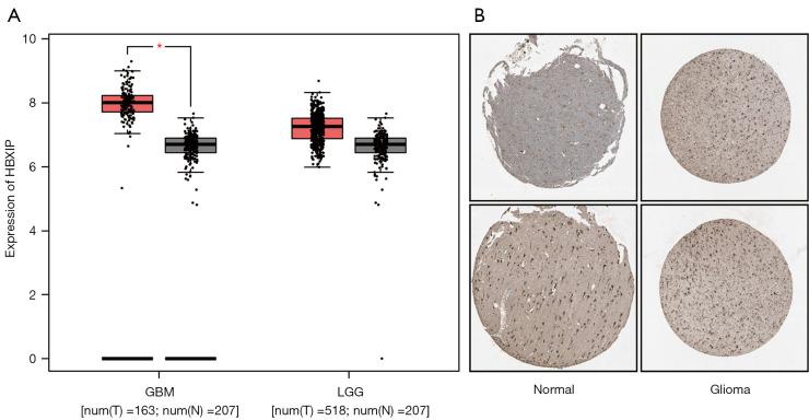 https://cdn.ncbi.nlm.nih.gov/pmc/blobs/3cf1/11651804/3a5949f671fc/tcr-13-11-6298-f2.jpg