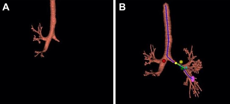 https://cdn.ncbi.nlm.nih.gov/pmc/blobs/3cf7/7054474/e72c3af1a949/40121_2020_283_Fig3_HTML.jpg
