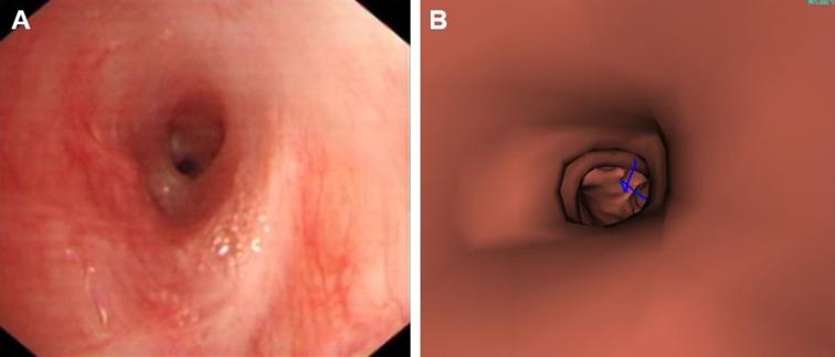 https://cdn.ncbi.nlm.nih.gov/pmc/blobs/3cf7/7054474/f837f22313a6/40121_2020_283_Fig2_HTML.jpg