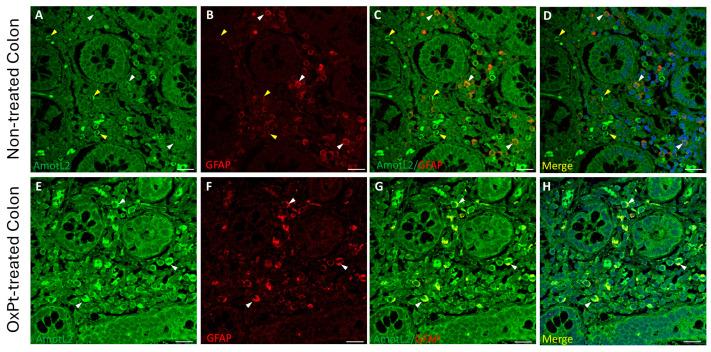https://cdn.ncbi.nlm.nih.gov/pmc/blobs/3d04/11429461/7efc4ecb6167/biomedicines-12-01952-g007.jpg