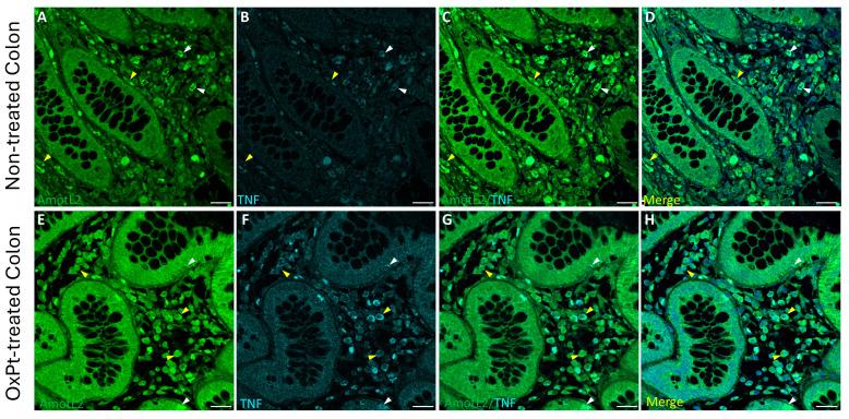 https://cdn.ncbi.nlm.nih.gov/pmc/blobs/3d04/11429461/9a0cc0e5f83b/biomedicines-12-01952-g005.jpg