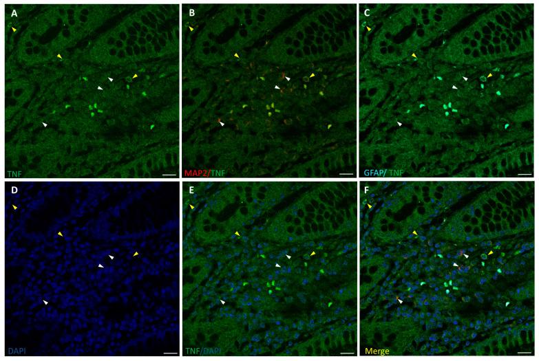 https://cdn.ncbi.nlm.nih.gov/pmc/blobs/3d04/11429461/b302d39842a1/biomedicines-12-01952-g004.jpg