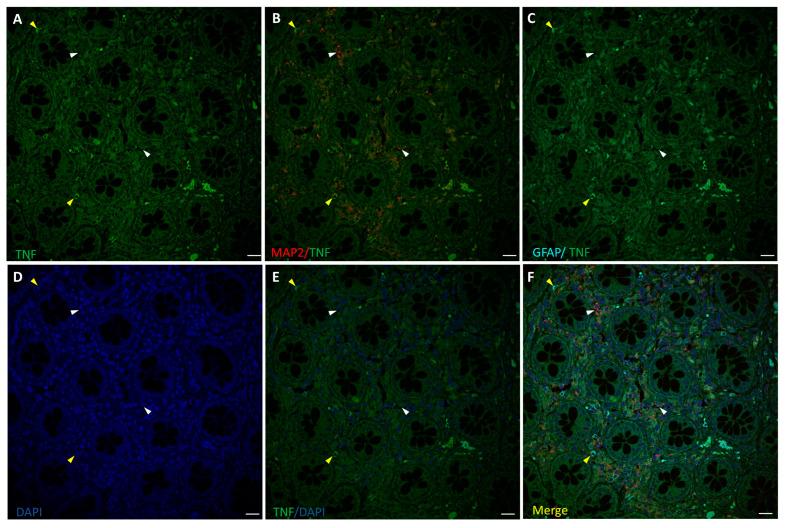 https://cdn.ncbi.nlm.nih.gov/pmc/blobs/3d04/11429461/ebbd40f91353/biomedicines-12-01952-g003.jpg