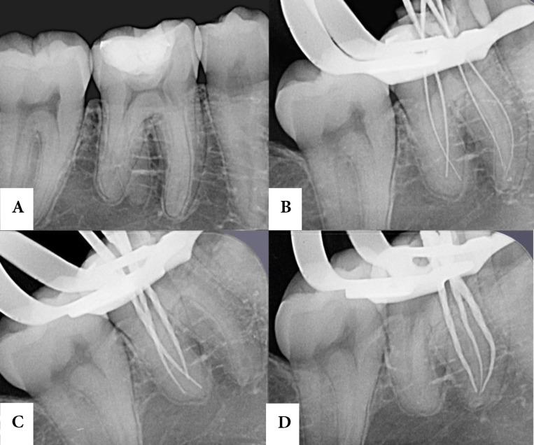 https://cdn.ncbi.nlm.nih.gov/pmc/blobs/3d04/9709878/b674c129e3ba/IEJ-16-65-g001.jpg