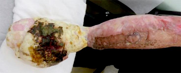 https://cdn.ncbi.nlm.nih.gov/pmc/blobs/3d06/9330348/093270b28ee6/amjcaserep-23-e936722-g001.jpg
